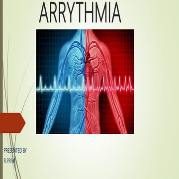 Arrythmia