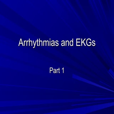 Arrythmias and ek gs 1