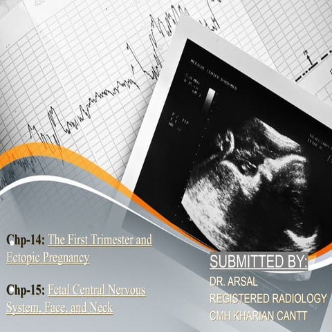 The First Trimester and Ectopic Pregnancy &   Fetal Central Nervous System, F...