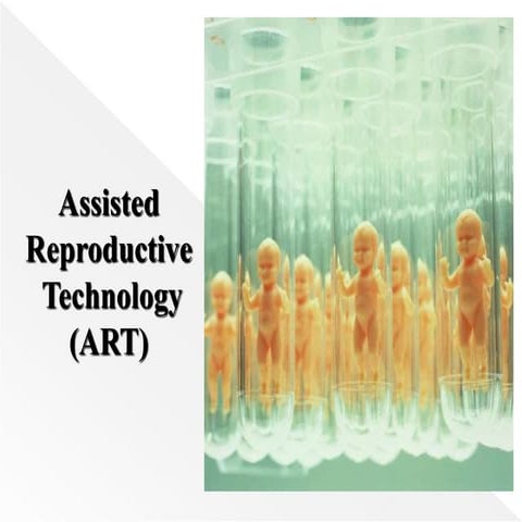 Assisted Reproductive Technology | PPTX
