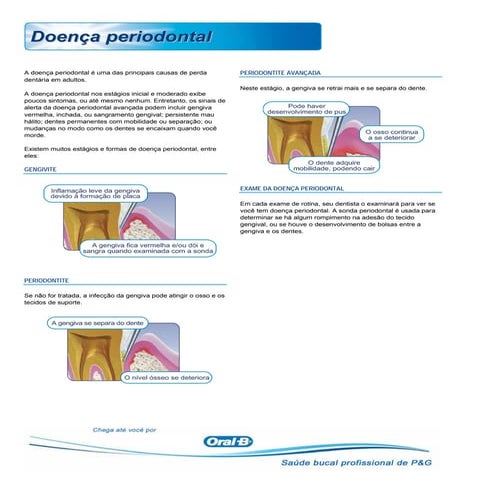 Doença periodontal