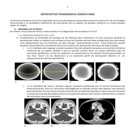 Artefactos en CT, ecografía, MRI y radiologia digital