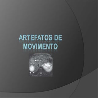 Artefatos de movimento