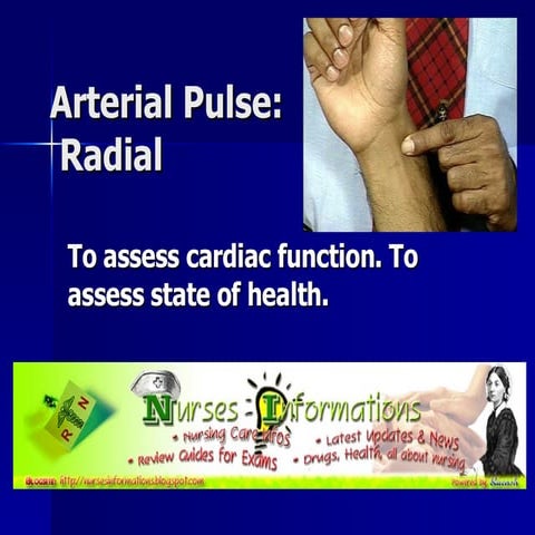 Arterial Pulse: Radial