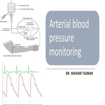 arterial line insertion in paediatric practice