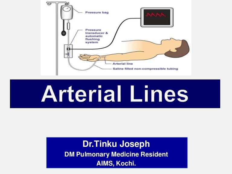 Arterial lines by Dr.Tinku Joseph