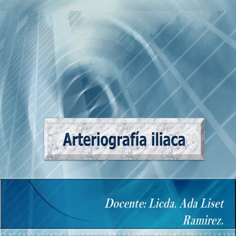 Arterio iliaca