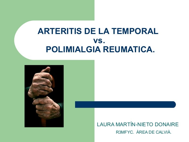 Polimialgia reumática complicaciones oculares de la hipertensión Polimialgia reumática complicaciones oculares de la hipertensión