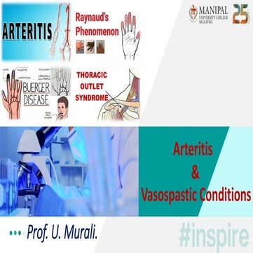 Arteritis, Thromboangitis Obliterans, RP & TOS... | PDF
