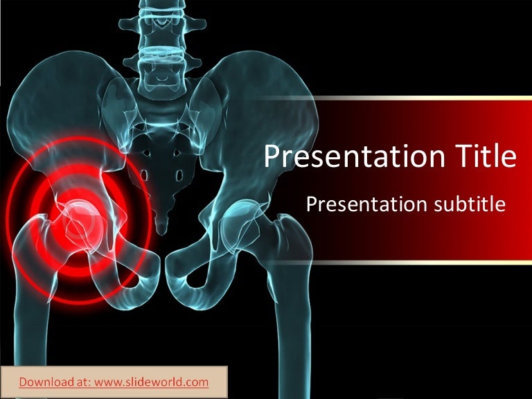 arthritis-powerpoint-template