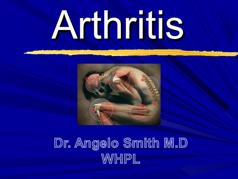 Arthritis