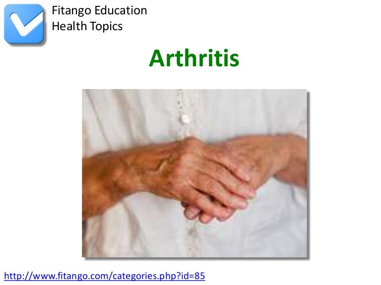 Arthritis