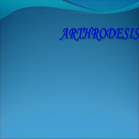 Arthrodesis