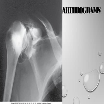 Arthrograms(3)