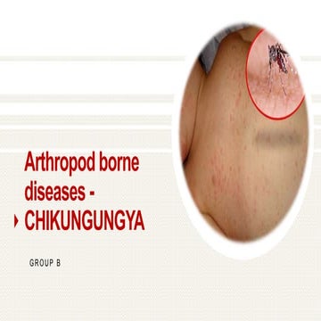 Chikungunya (Athropod Borne Diseases)