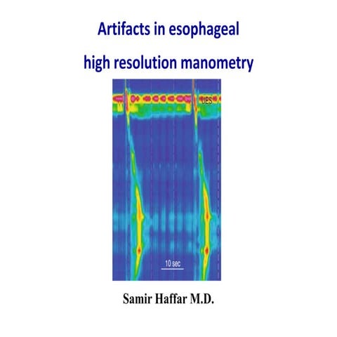 Artifacts in esophageal high resolution manometry