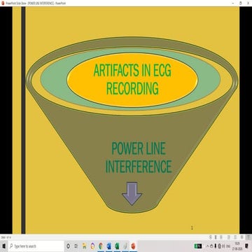 ARTIFACTS ON ECG RECORDING