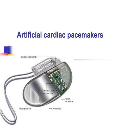Artificial_Pacemaker presentation in detailed