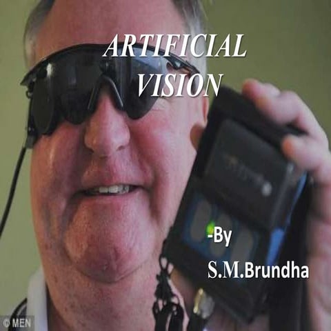 Artificial vision