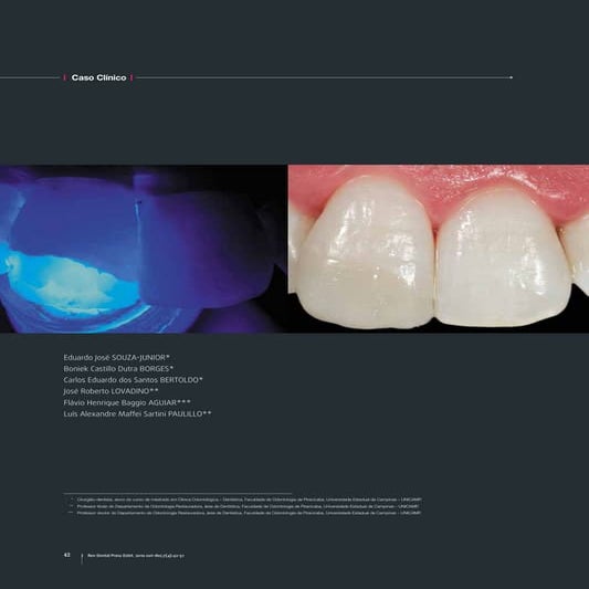 Artigo dental press 2010
