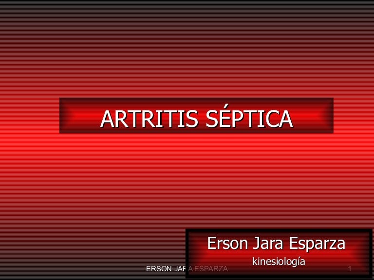Artritis Séptica Neonatal Reporte De Un Caso Cuidados De Enfermeria En Artritis Septica