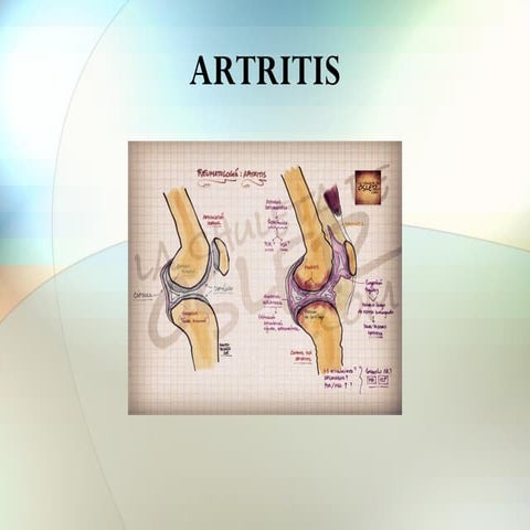 Artritis
