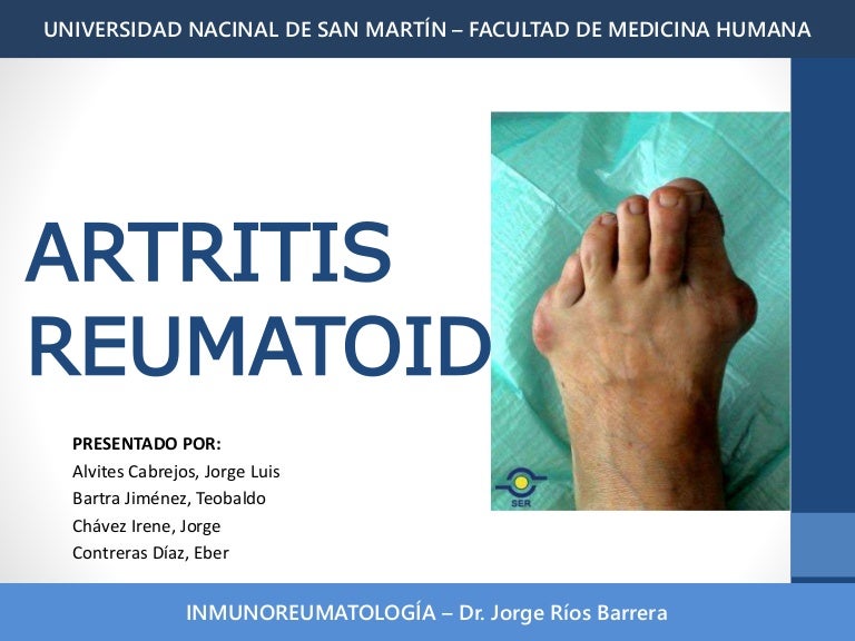 artritis reumatoidea nodulos pdf