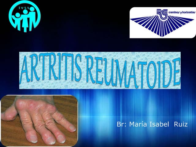 diabetes artritis reumatoide palindrómica emedicina diabetes diabetes artritis reumatoide palindrómica emedicina diabetes