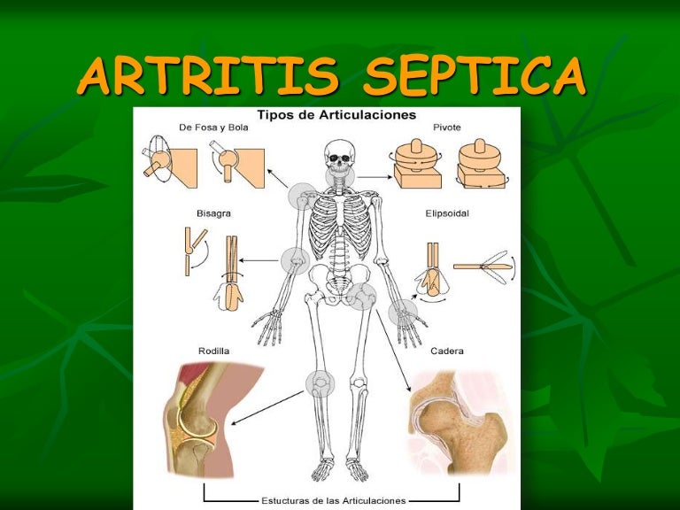 fir de lână durere articulară semne de inflamație articulară la nivelul piciorului