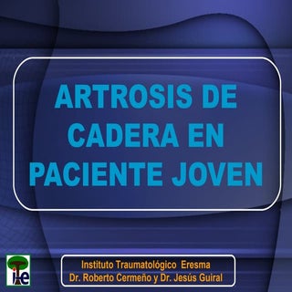 Artrosis de cadera en paciente joven