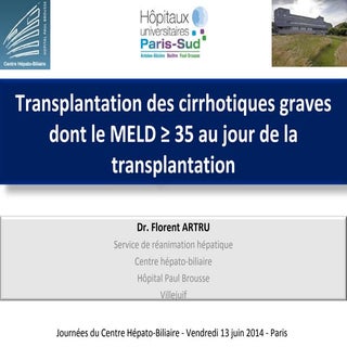 La Transplantation hépatique pour l...