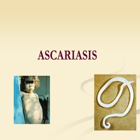 ASCARIASIS.ppt