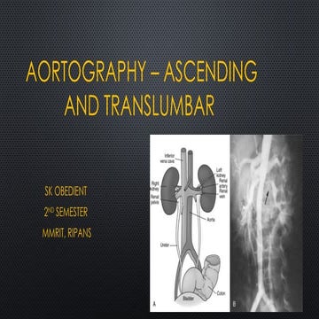 Ascending and Translumbar aortography presentation. | PPTX