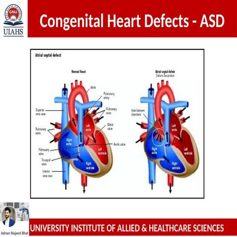 Foundations and Clinical Management of Congenital Heart Defects | PDF