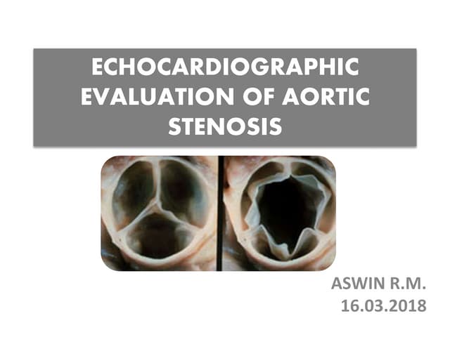 Echocardiographic Evaluation of LV Diastolic Function | PDF