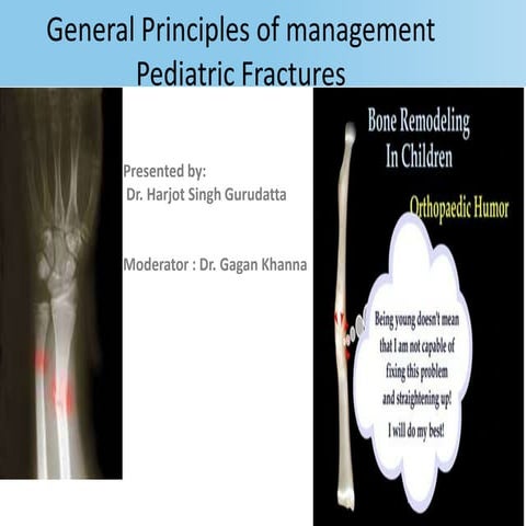orthopaedic fractures in children 