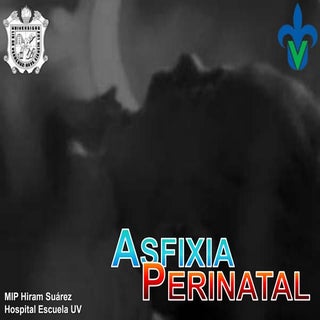 Asfixia perinatal