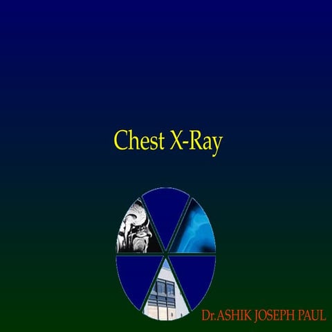 Cheat X-ray normal anatomy and patholgies For medical students