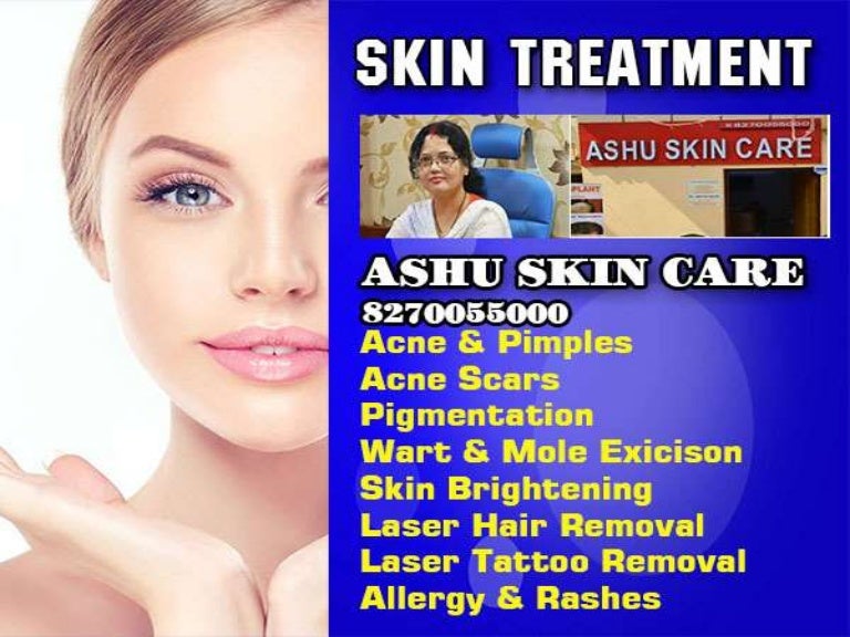 best skin clinic for acne scars