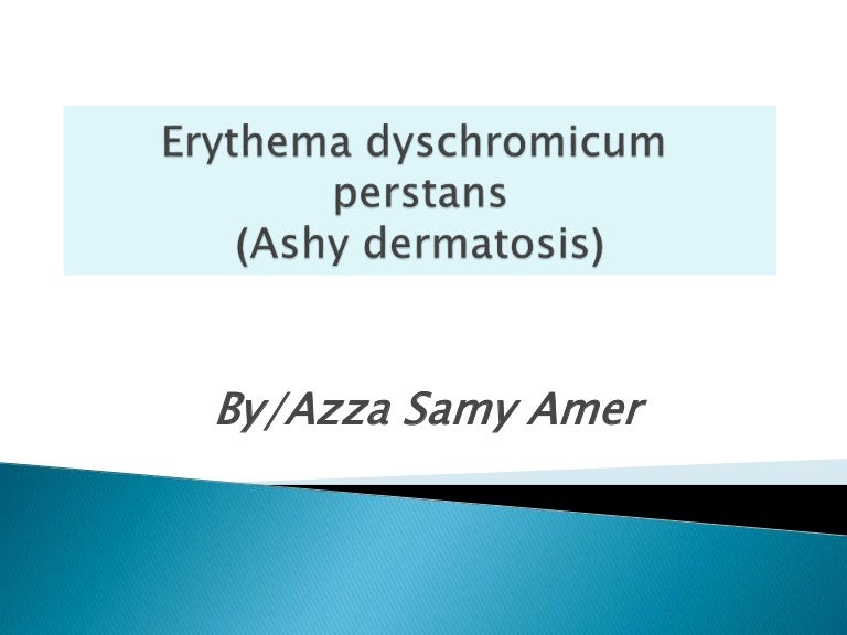 Ashy dermatosis