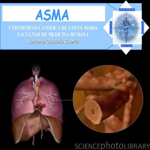 Asma