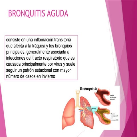 asma.pptxjhhvjljijyyguih nm m ,,nkñmmb n