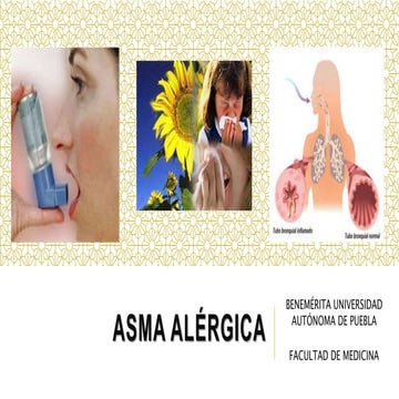 ASMA INTRINSECA O CRIPTOGENICA DEL ADULTO | DOCX