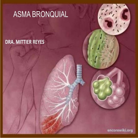 Asma Bronquial 