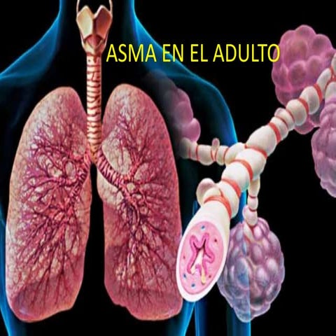 Asma en el adulto