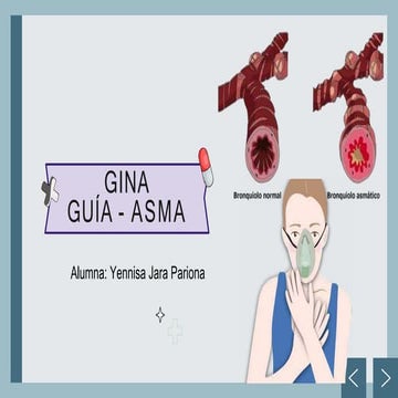 ASMA GINA 2024 [Autoguardado] (1)2024.pptx