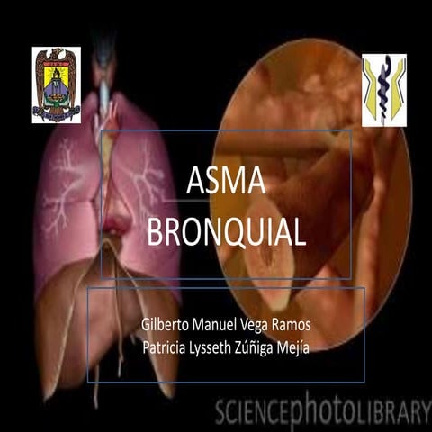 Tratamiento del Asma