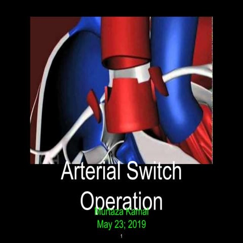 ASO: ARTERIAL SWITCH OPERATION