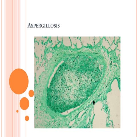 Aspergillosis