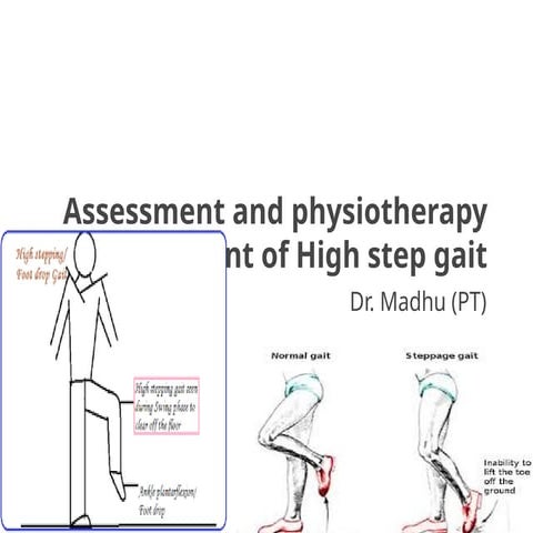 Assessment and physiotherapy management of High step gait.pptx